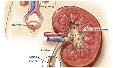 advanced urology clinic in Ahmedabad