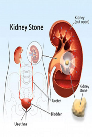 pediatric urologist surgeon in ahmedabad