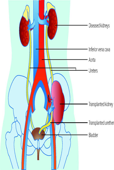 best urologist doctors in ahmedabad